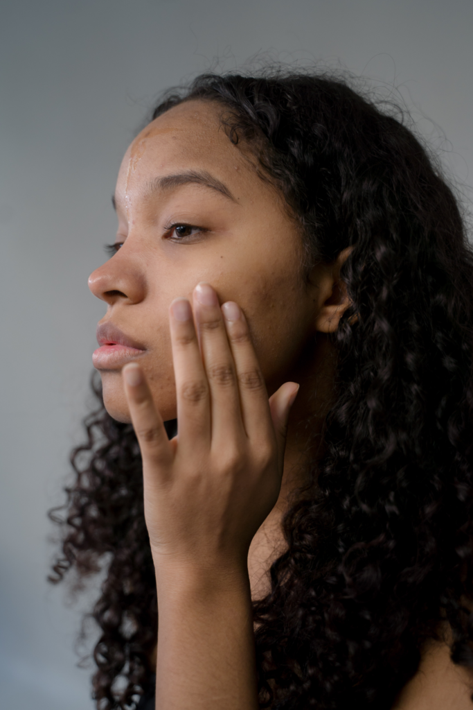 9 effective habits to get rid of acne